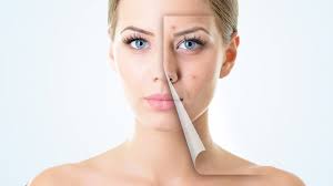Overcoming Scars: The Benefits of Using Scar Removal Creams