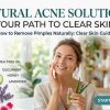 How to Remove Pimples Naturally: Clear Skin Guide